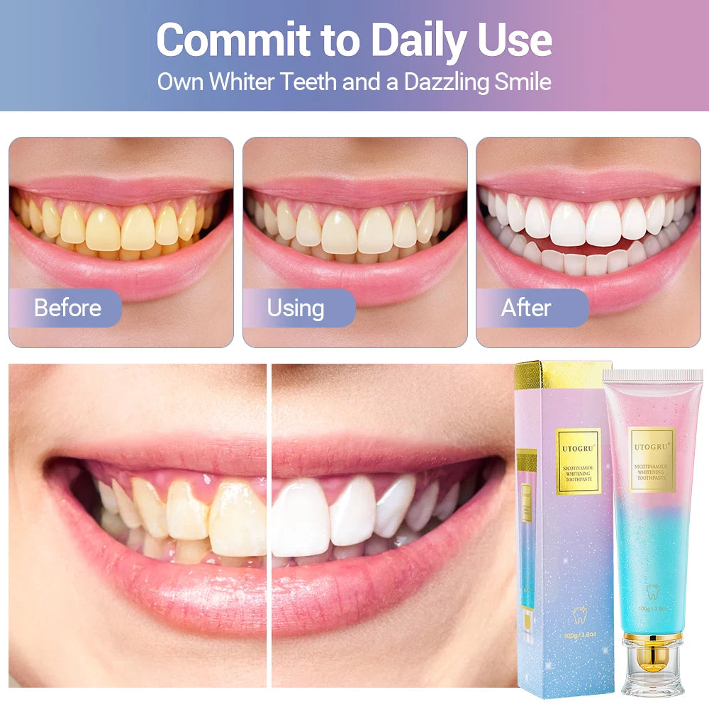 Radiant Smile Whitening Toothpaste